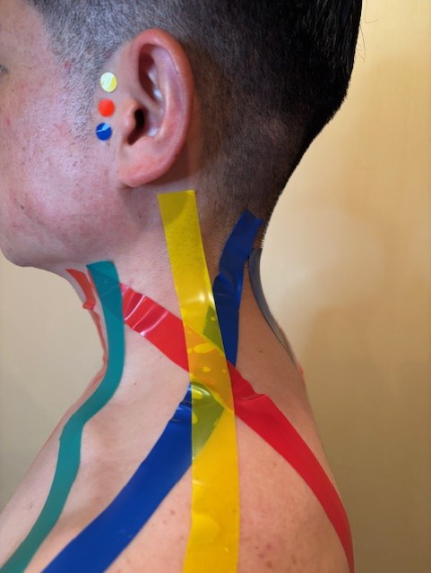 頚部外側部写真